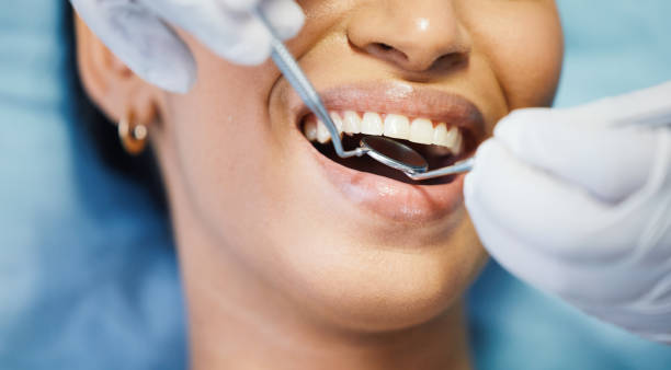 Best Cracked Tooth Emergency Dentist  in Lake Lotawana, MO
